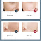 7 Colors LED Facial Mask PDT Light Therapy